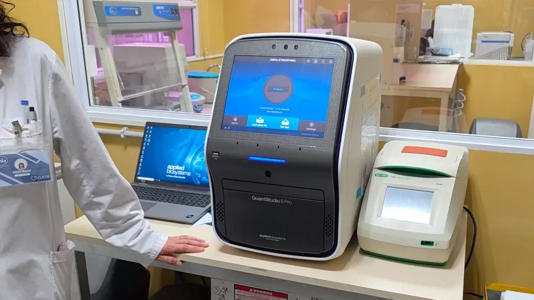salta incorpora tecnologia unica en el noa para fortalecer el sistema de trasplantes
