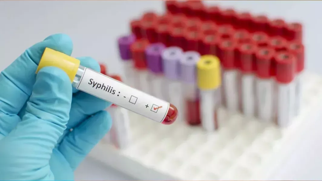 sifilis en alza el cierre de 2025 dejo un pico de contagios en salta