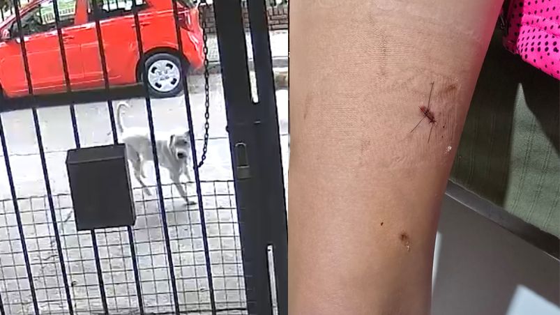 un dogo ataco a una nena en cordoba y todo quedo filmado vino directo a morderla