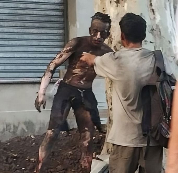 santa fe impactante intento robar cables se electrocuto y termino con el 90 del cuerpo quemado
