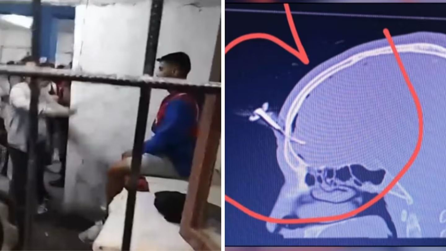 le clavaron una llave en la cabeza durante una feroz pelea y hubo shock en un partido juvenil