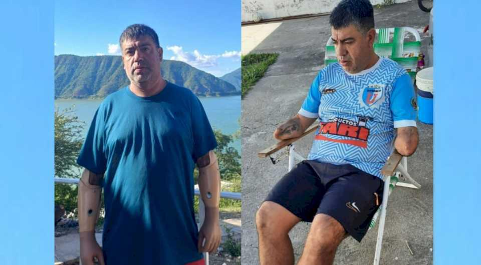 unos trapitos le robaron las protesis de sus brazos en un semaforo y pide ayuda para encontrarlas