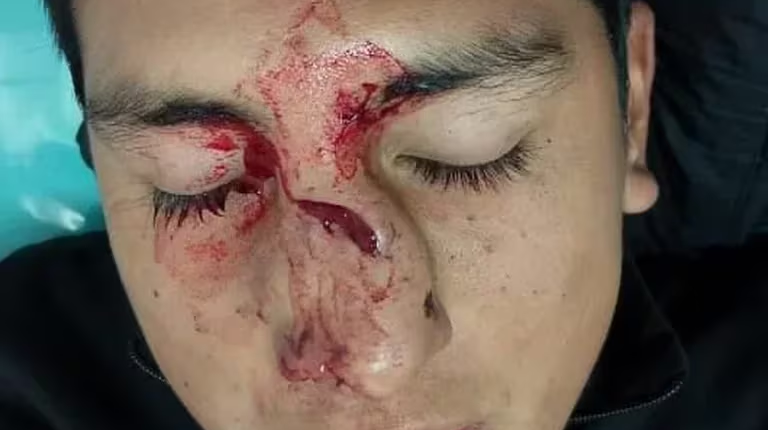 imputaron al hombre que agredio al arbitro en el torneo de la loma