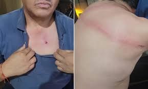 imputan a un hombre y a su hija por amenazas y lesiones a un inspector municipal en pleno operativo de fin de ano