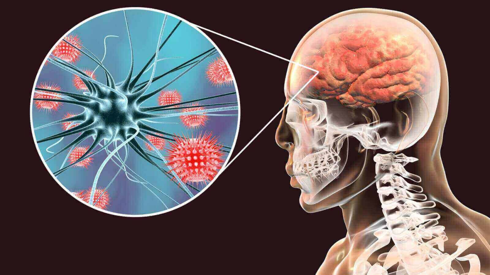 salta mantiene la vigilancia por meningitis ya se notificaron ocho casos en 2026