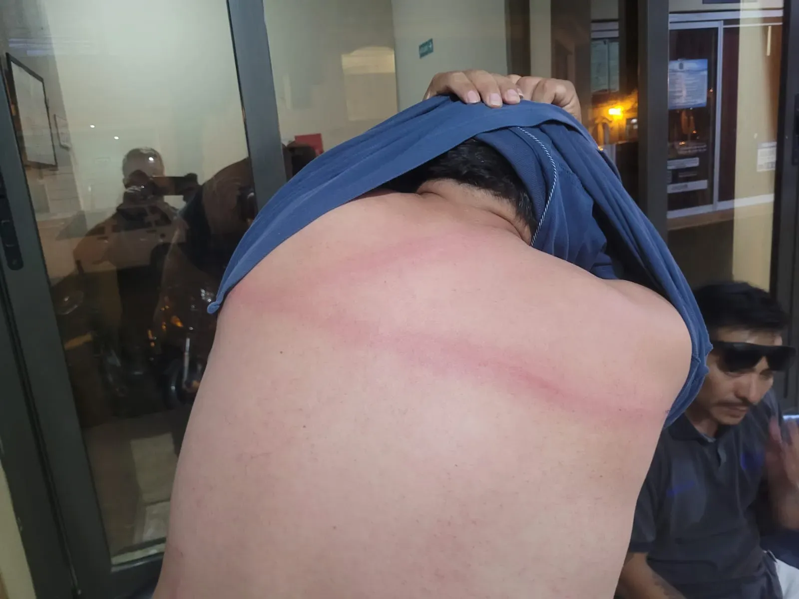 denuncian que un vendedor agredio a un inspector municipal con una cadena