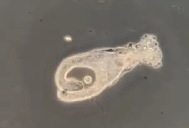 Qué es la ameba "come cerebros" que mató a un chico en Catamarca y cómo evitar el contagio