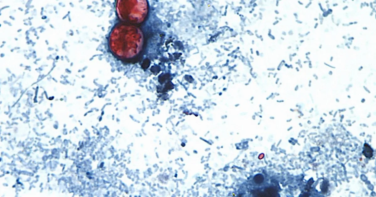Qué es la Cyclospora, el parásito de la lechuga contaminada que provocó 13 mil casos de diarrea en EE.UU.