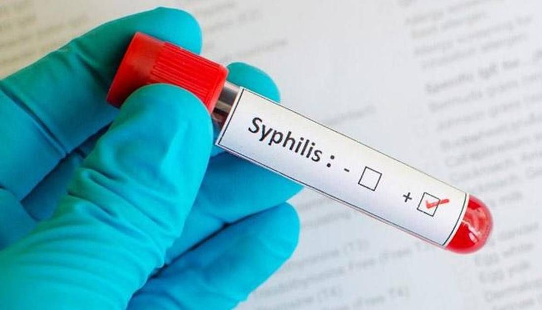 aumentan los casos de sifilis en salta y salud pide reforzar la prevencion